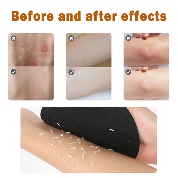 🛁4-in-1 Exfoliating Scrubber Set | Reveal Silky Smooth Skin In Every Shower(4PCS)