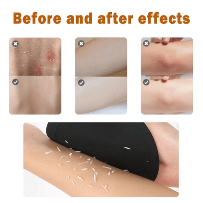 🛁4-in-1 Exfoliating Scrubber Set | Reveal Silky Smooth Skin In Every Shower(4PCS)
